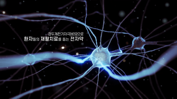두둠 포트폴리오 - 뉴로핏innk 경두개 전기 자극기기 3D그래픽 소개 영상