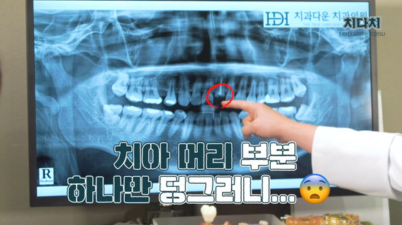 두둠 포트폴리오 - 치다치 치과다운치과의원 정보전달 유튜브 콘텐츠 영상